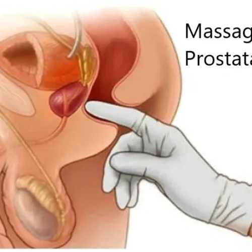 massaggioprostata2